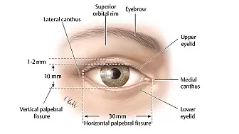 Göz Kapağı Düşüklüğüne Sebep Olan Faktörler Araştırıldı!